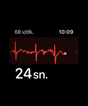 EKG uygulaması, sağ üst köşede vuruş/dakika, ritim çizgisi, zamanlayıcı