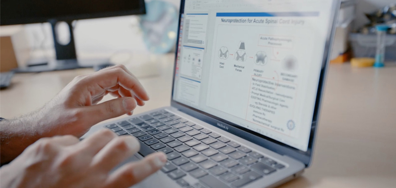 يدان تطبعان على جهاز MacBook&nbsp;Pro‏.